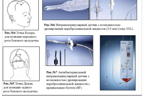 Как найти сайт меги блэкспрута